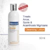 Skinenjoy® Cleansing Lotion for Acne & Spots & Acanthosis Nigricans